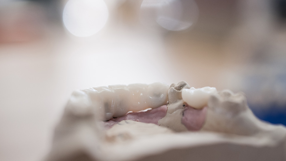 Implantate für Zahnärzte in Fulda